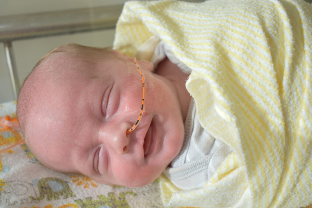 Sonda NG Qué esperar después del procedimiento